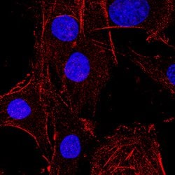 Mouse Fibroblast Activation Protein alpha/FAP Antibody, R D Systems:Antibodies:Primary