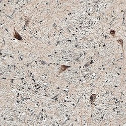 Human/Mouse/Rat GABAB R2 Antibody, R D Systems:Antibodies:Primary Antibodies