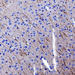 Human/Mouse/Rat GABAB R2 Antibody, R D Systems:Antibodies:Primary Antibodies