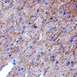 Human/Mouse/Rat GABAB R2 Antibody, R D Systems:Antibodies:Primary Antibodies