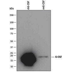 Human G-CSF Antibody, R D Systems 1mg; Unlabeled:Antibodies, Polyclonal