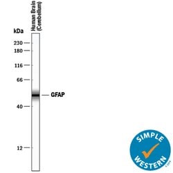 Human/Rat GFAP Antibody, R D Systems 25 &mu;g | Buy Online | R&D Systems | Fisher Scientific