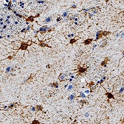 Human GFAP Antibody, R D Systems 100&mu;g:Antibodies, Monoclonal