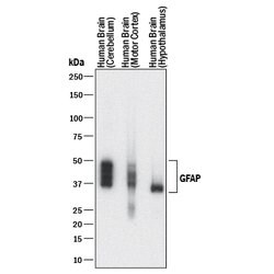 Human GFAP Antibody, R D Systems 100&mu;g:Antibodies, Monoclonal