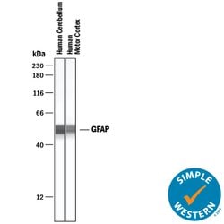 Human GFAP Antibody, R D Systems 100 &mu;g | Buy Online | R&D Systems | Fisher Scientific