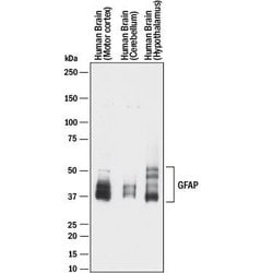 Human GFAP Antibody, R D Systems 100 &mu;g | Buy Online | R&D Systems | Fisher Scientific