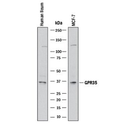 Human GPR35 Antibody, R D Systems 100 &mu;g; Unconjugated:Antibodies, Monoclonal