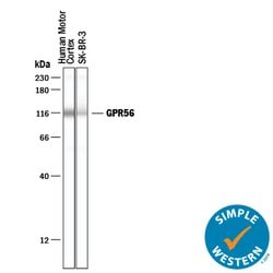 Human GPR56 Antibody, R D Systems 100&mu;g; Unlabeled:Antibodies, Polyclonal