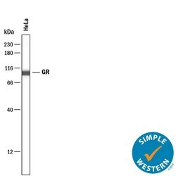 Human/Rat GR/NR3C1 Antibody, R D Systems GR/NR3C1 Antibody; Unconjugated;