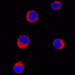 Human GRK3 Antibody, R D Systems:Antibodies:Primary Antibodies