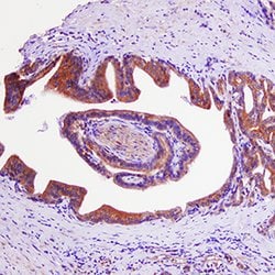 Human GRK3 Antibody, R D Systems:Antibodies:Primary Antibodies