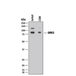 Human GRK3 Antibody, R D Systems:Antibodies:Primary Antibodies
