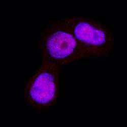 Human/Mouse GSK-3 alpha/beta Antibody, R D Systems 25&mu;g; Unlabeled:Antibodies,