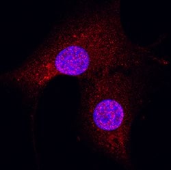 Human/Mouse GSK-3 alpha/beta Antibody, R D Systems 25&mu;g; Unlabeled:Antibodies,