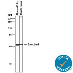 Human/Mouse/Rat Galectin-4 Antibody, R D Systems 25&mu;g; Unlabeled:Antibodies,