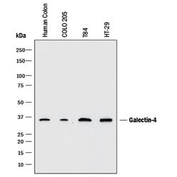 Human Galectin-4 Antibody, R D Systems 500ug; Unlabeled:Antibodies, Monoclonal