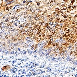 Human Galectin-7 Antibody, R D Systems:Antibodies:Primary Antibodies