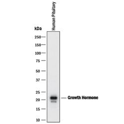Human Growth Hormone Antibody, R D Systems 25&mu;g; Unlabeled:Antibodies,