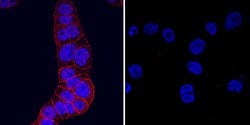 Mouse HGFR/c-MET Antibody, R D Systems 25 &mu;g | Buy Online | R&D Systems | Fisher Scientific