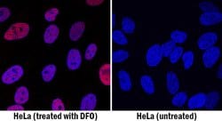 Human HIF-1 alpha/HIF1A Antibody, R D Systems 100 &mu;g; Unconjugated:Antibodies,