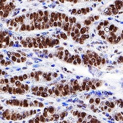 Human HNF-3 alpha/FoxA1 Antibody, R D Systems 100ug; Unlabeled:Antibodies,
