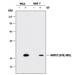 Human HSP27 (S78/S82) Antibody, R D Systems:Antibodies:Primary Antibodies