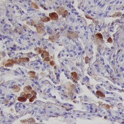 Human HVEM/TNFRSF14 Antibody, R D Systems 500ug; Unlabeled:Antibodies,