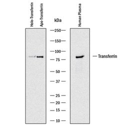 Human Transferrin Antibody, R D Systems 100&mu;g:Antibodies