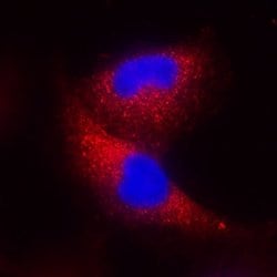 Human IFN-beta Antibody, R D Systems 100&mu;g:Antibodies, Monoclonal