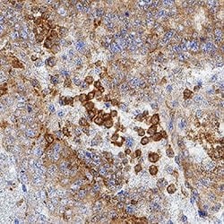 Human IFN-epsilon Antibody, R D Systems 100&mu;g:Antibodies, Monoclonal