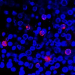 Human IFN-gamma Antibody, R D Systems 25 &mu;g | Buy Online | R&D Systems | Fisher Scientific