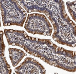 Human IFN-lambda 4 Antibody, R D Systems 25&mu;g:Antibodies, Monoclonal