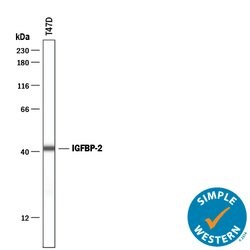 Human IGFBP-2 Antibody, R D Systems 25&mu;g; Unlabeled:Antibodies, Polyclonal