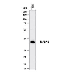 Human IGFBP-2 Antibody, R D Systems 25&mu;g; Unlabeled:Antibodies, Polyclonal