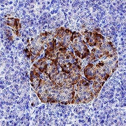 Human IGFBP-rp1/IGFBP-7 Antibody, R D Systems:Antibodies:Primary Antibodies