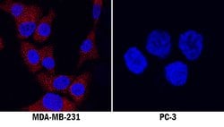 Human IGF-I/IGF-1 Antibody, R D Systems 100 &mu;g; Unconjugated:Antibodies,