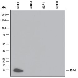 Human IGF-I/IGF-1 Antibody, R D Systems 500&mu;g; Unlabeled:Antibodies,