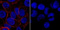 Human/Mouse IGF-I R/IGF1R Antibody, R D Systems 25&mu;g; Unlabeled:Antibodies,