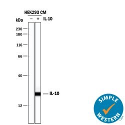 Human IL-10 Antibody, R D Systems 1mg; Unlabeled:Antibodies, Polyclonal