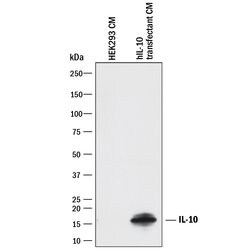 Human IL-10 Antibody, R D Systems 1mg; Unlabeled:Antibodies, Polyclonal