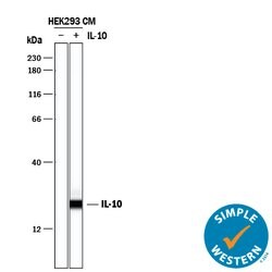 Human IL-10 Antibody, R D Systems 25&mu;g; Unlabeled:Antibodies, Polyclonal