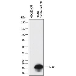 Human IL-10 Antibody, R D Systems 25&mu;g; Unlabeled:Antibodies, Polyclonal