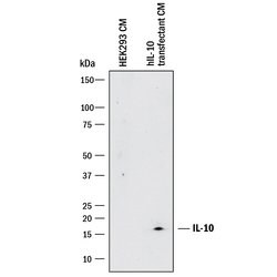 Human IL-10 Antibody, R D Systems 500&mu;g; Unlabeled:Antibodies, Monoclonal