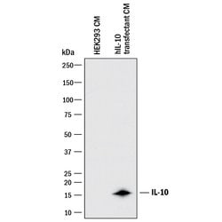 Human IL-10 Antibody, R D Systems 100&mu;g; Unlabeled:Antibodies, Monoclonal