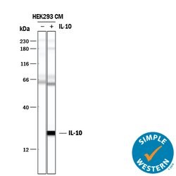 Human IL-10 Antibody, R D Systems:Antikörper:Primärantikörper