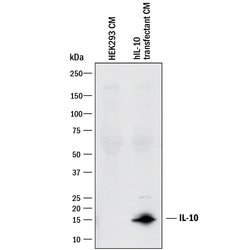 Human IL-10 Antibody, R D Systems:Antikörper:Primärantikörper