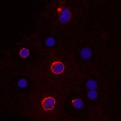 Human IL-12 p70 Antibody, R D Systems:Antibodies:Primary Antibodies