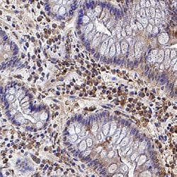 Human/Primate IL-17/IL-17A Antibody, R D Systems 100&mu;g; Unlabeled:Antibodies,
