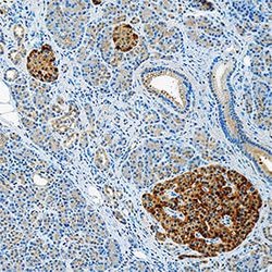 Human IL-18/IL-1F4 Antibody, R D Systems 100 &mu;g; Unconjugated:Antibodies,