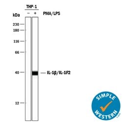 Human IL-1 beta/IL-1F2 Antibody, R D Systems:Antibodies:Primary Antibodies